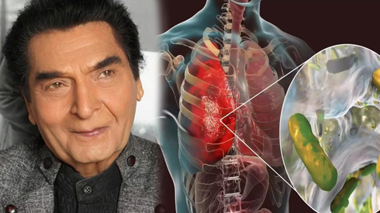 Asrani Death Reason: Fefdo Me Pani भरने से निधन, Kaise Bharta Hai, Kya Lakshan | Lungs Water Problem