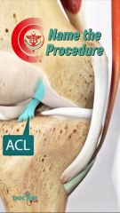 What is the name of this procedure?