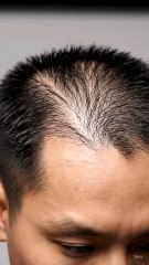 tag someone who need this hair remover spray