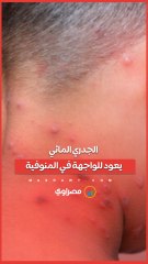 الجدري المائي يعود للواجهة في المنوفية