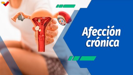 Actitud Saludable | ¿Sabes qué es la endometriosis y cómo se origina?