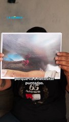 Dueño de pitbull ofrece apoyo y denuncia agresión