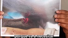 Dueño de pitbull ofrece apoyo y denuncia agresión