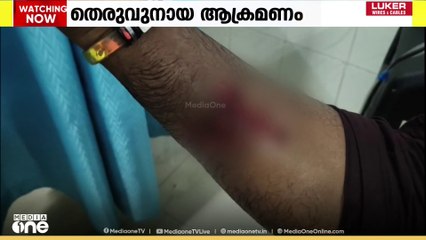 കോഴിക്കോട് കല്ലാച്ചിയിൽ തെരുവുനായ ആക്രമണം; 15 പേർക്ക് കടിയേറ്റു