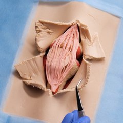 Un guide simple pour comprendre la chirurgie des ligaments du genou