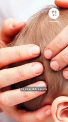 Ton bébé peut finir avec la tête déformée ?