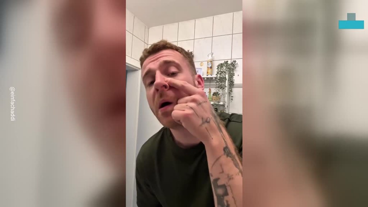 Man Pulls Qtip Out of Nose