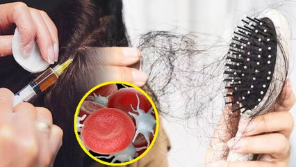 Hair Fall Treatment:बाल झड़ना कैसे रोके,PRP और GFC ट्रीटमेंट क्या है | Benefits In Hindi | Boldsky