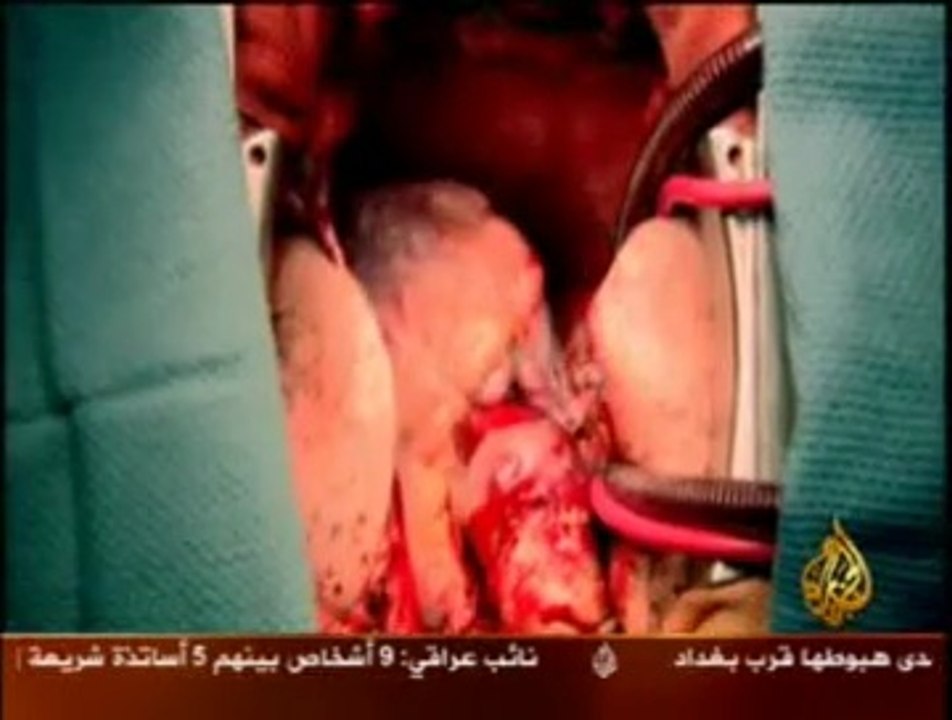 لقلب يحتو ي على عقل صغير   Heart
