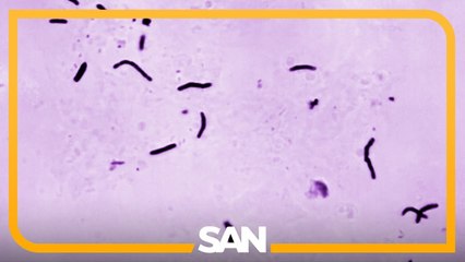 TB is spreading in ICE detention centers. So what’s the agency’s responsibility?