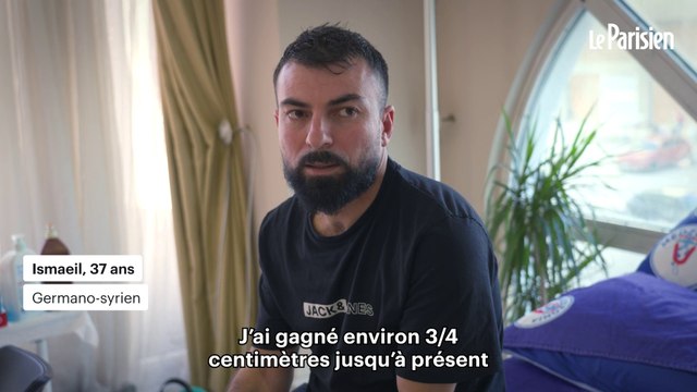 « J’ai gagné 12 cm » : grandir se faisant casser les jambes