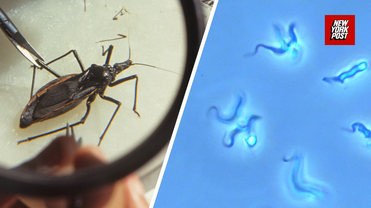 What is Chagas Disease? The Scary Truth About the 'Kissing Bug' Parasite Spreading in the US