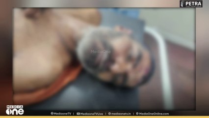 യുവാവിന്റെ ജനനേന്ദ്രിയം മുറിച്ചു, കണ്ണിന്റെ കാഴ്ച നഷ്ടപ്പെടുത്തി; ക്രൂരമർദനം