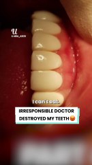 Her $750 teeth backfired horribly 😱