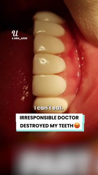 Her $750 teeth backfired horribly 😱