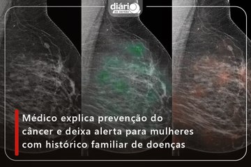 Médico explica prevenção do câncer e deixa alerta para mulheres com histórico familiar de doenças