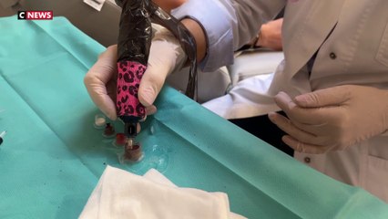 Octobre Rose : la reconstruction est une phase importante après le cancer