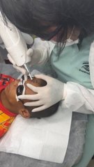 10-year-old boy has tattoo removed after bullies inked vulgar word on forehead