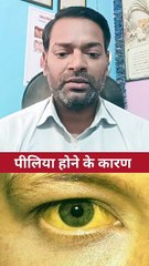 पीलिया होने के कारण ।