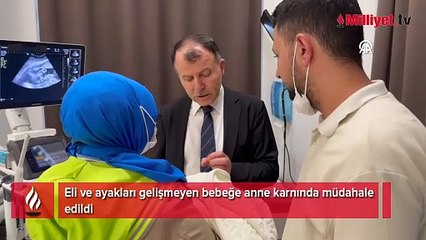 Elsiz ve ayaksız doğma ihtimali vardı! Anne karnında operasyon