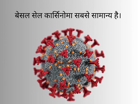 Types of Skin Cancer – Understanding Different Forms of Skin Cancer