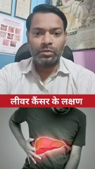 लीवर कैंसर के लक्षण ।