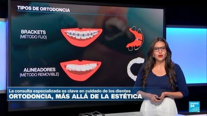 Precauciones para tener en cuenta si busca una "sonrisa perfecta"