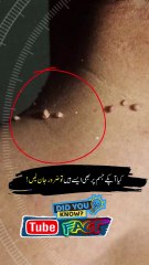 Kia Ap Ky Jisam Par Bhi Hain 😱 #Shorts #facts #amzingfacts #Viralshorts #shortsfeed