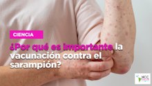 ¿Por qué es importante la vacunación contra el sarampión?