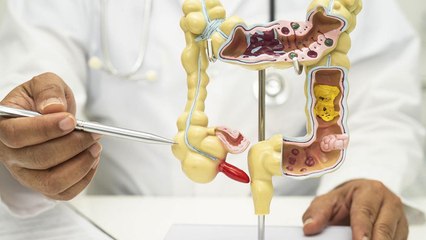 Why Your Appendix Might Be More Useful Than You Think