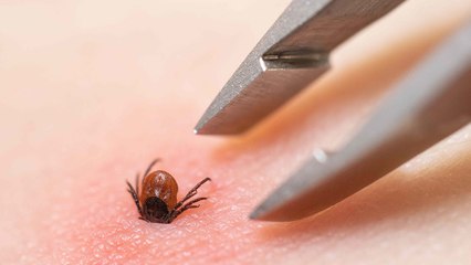 8 Areas On Your Body Ticks Love To Bite