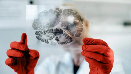 How to Reduce Toxic Tau Protein and Lower Alzheimer’s Risk