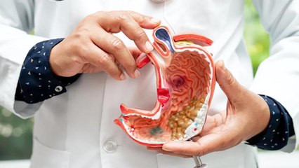 Stomach Cancer in Young Adults Is Increasing—Watch for These 6 Early Signs