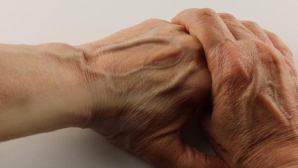 Why Are My Veins Suddenly Bulging and Visible?