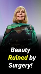 Kim Novak’s Plastic Surgery 'Disaster' Top Doc Warns of Hollywood’s Beauty Obsession