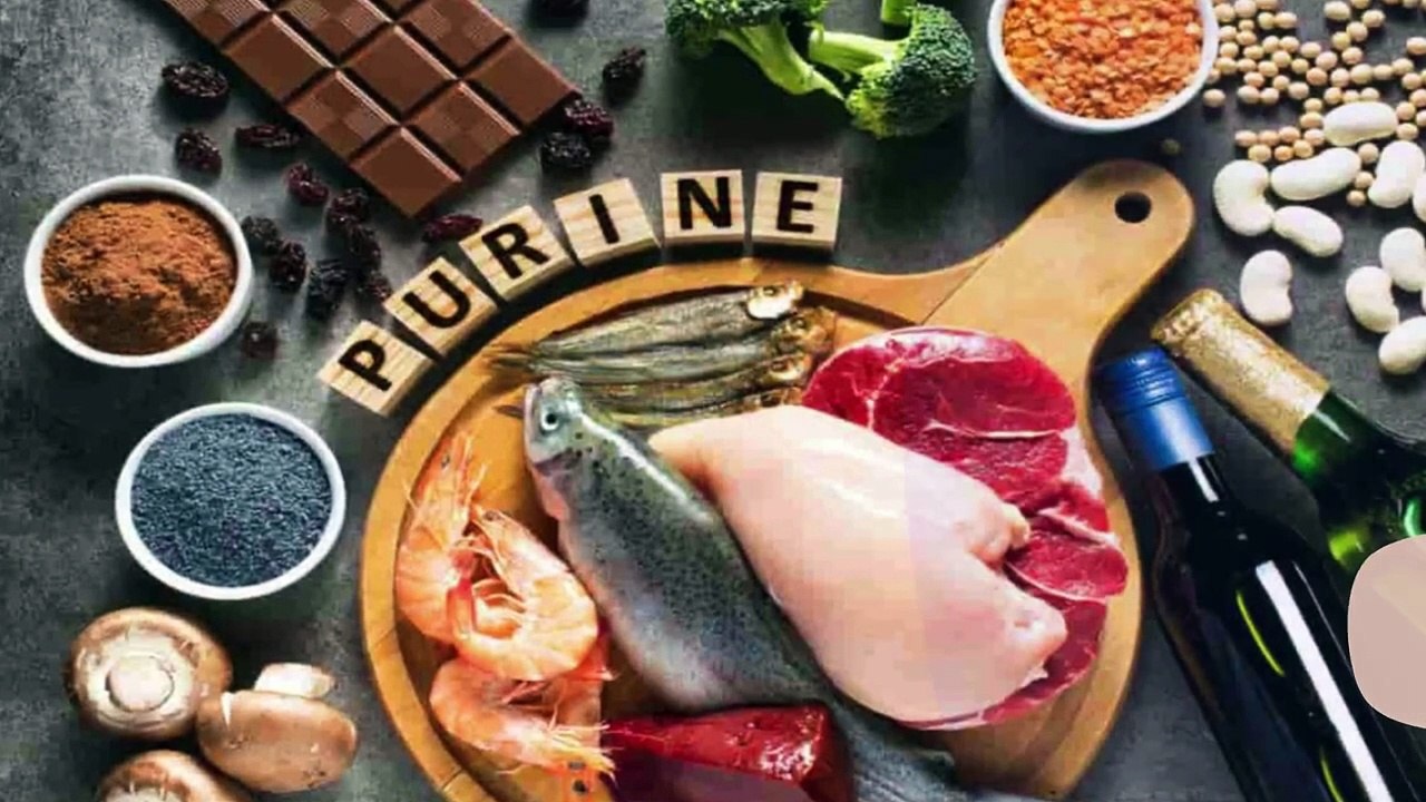 10 Cara mencegah dan Menyembuhkan Asam Urat Tanpa Obat yang Penting untuk Diketahui