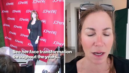 See 'RHONY' alum Jill Zarin's face transformation after being called out for having 'an entirely different face' on social media
