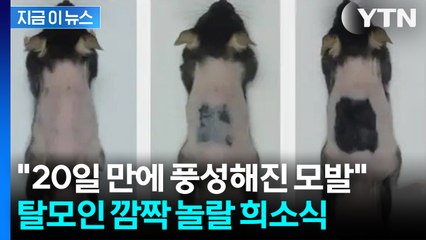 타이완 연구진 ‘모낭 재생 세럼’ 개발...20일 만에 모발 복원 성공 [지금이뉴스] / YTN