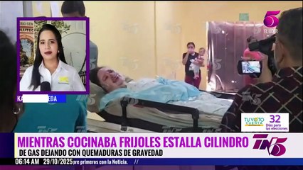 Mujer resulta con quemaduras por explosión en su cocina