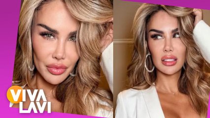 Ninel Conde se somete a cirugía para cambiarse el color de ojos
