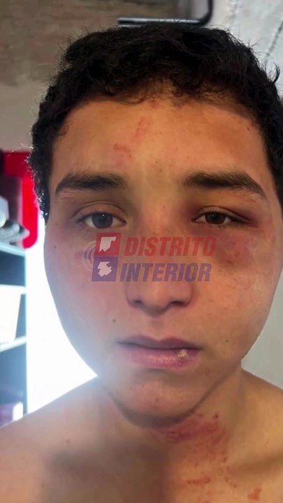 “Me sacó la oreja “: el testimonio del joven torturado por sus jefes en una estancia