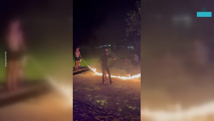 Girl Gets Burned While Jumping Rope