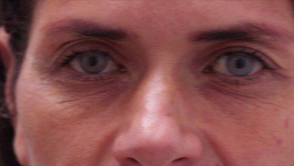 Des médecins alertent sur la keratopigmentation, une opération permettant de modifier la couleur de ses yeux