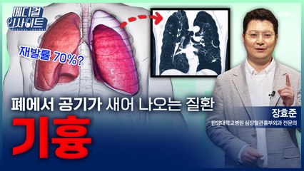 [메디컬 인사이트 108회] 흉부외과 전문의가 알려주는 '기흉의 증상과 치료법' / YTN