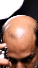 💨 One Spray — Endless Satisfaction! 💆‍♂️Watch how every droplet works its magic — whether it’s removing hair instantly or making new hair appear like magic.