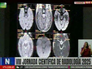Impulsan formación académica y avance tecnológico en VII Jornada Científica de Radiología