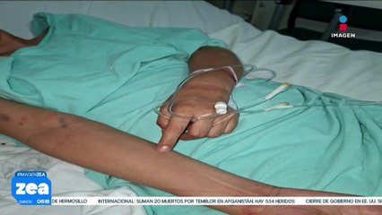 Mujer es agredida por policías municipales de Morelos tras presenciar una detención