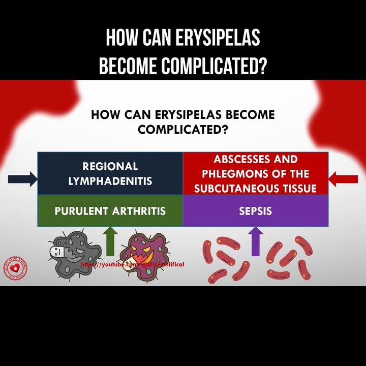How can erysipelas become complicated?