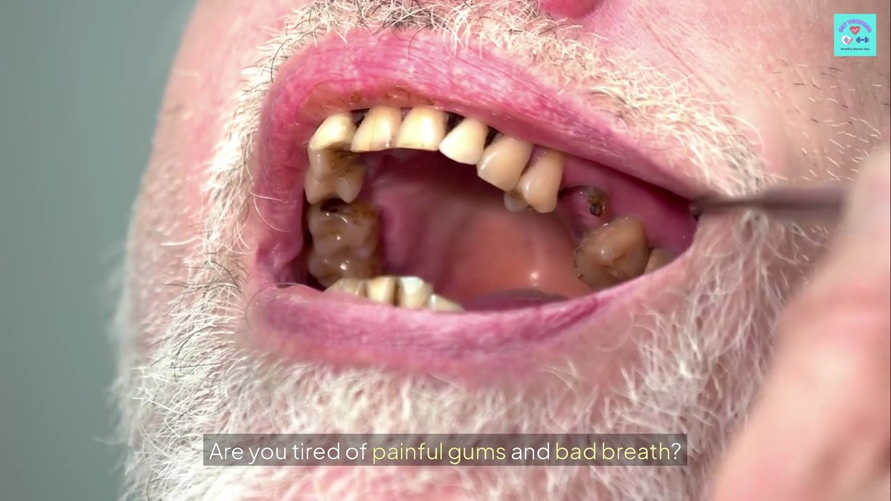 "Gum Disease Gone" by Julissa Clay: KILL Gum Disease – NO Surgery/Drugs! 😱