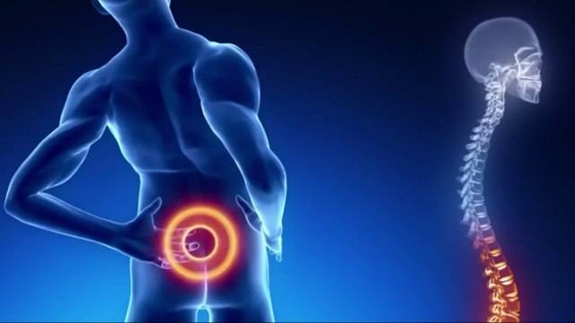 tn7-Dolor lumbar y problemas de columna aumentan en Costa Rica, según nuevo estudio-011125